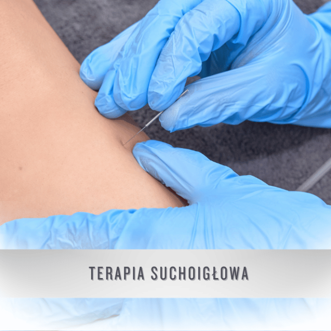 terapia suchoigłowa